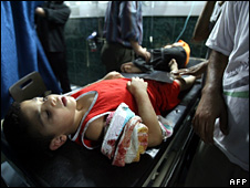 Một bé trai bị thương trong vụ đánh bom bên bờ biển (ngày 25 tháng Bảy năm 2008)