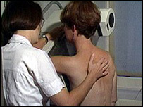 vyšetření na mamografu