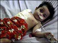 इराक़ी अस्पताल