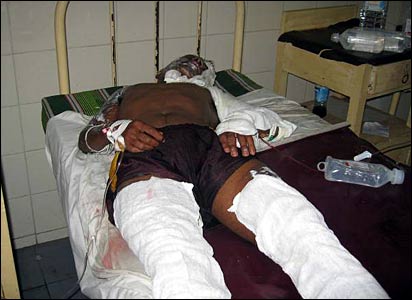 Injured in the hospital (photo elmo Fernando)