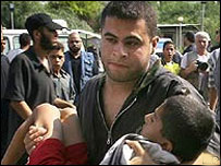 İsrail saldırısında yaralanan Filistinli bir çocuk