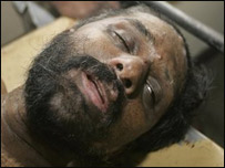 Poddala Jayantha in hospital after the assault (file photo)