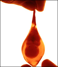 خورنريزی پس از سقط