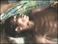 اُڑیسہ میں ہیضے کے مریض