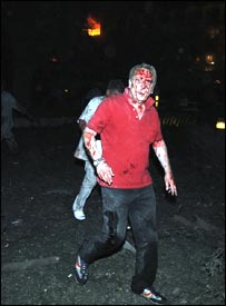 زخمی غیر ملکی