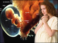 ذهني کمزوري