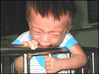 Một cháu bị nhiễm HIV ở Việt Nam