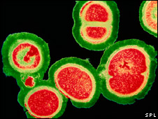 MRSA bacteria