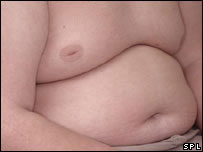 زیابیطس اور موٹاپا