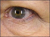 Rosto de voluntária antes do tratamento