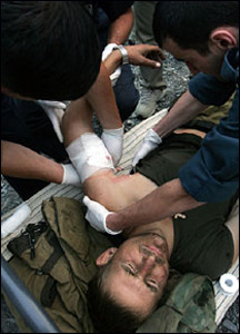 Lính Nga bị thương