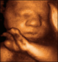 20周的婴儿胚胎像