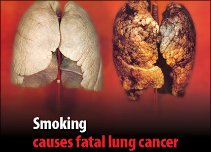 smoking_lungs.jpg