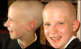 Susannah without hair 