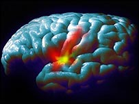 मस्तिष्क 