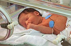 Premature Baby