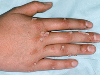 پر بدن دزخو راختل