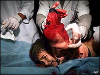 Menino palestino ferido é atendido em hospital de Gaza