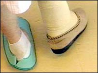 ٹوٹی ہوئی ہڈی