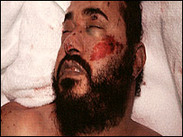 ज़रक़ावी का शव