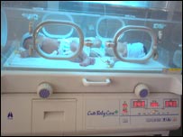 خوارځواکی ماشوم