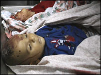 İsrail saldırısında ölen çocuklar