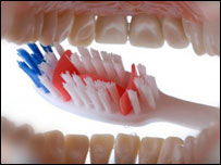  د غاښونو خرابيدل