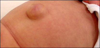 چوره شوی ماشوم