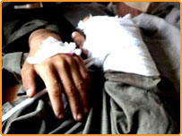 Поранений пакистанський військовий