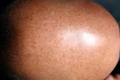 Close-up of a bald head