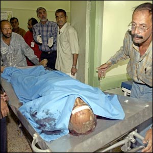 विस्फोट के बाद बग़दाद के अस्पताल में लाया गया एक व्यक्ति