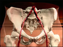 Imagem digital mostrando pernas e artérias