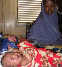 Mãe com filho ferido em Mogadíscio