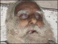 بھیک مانگنا ضرورت یا عادت