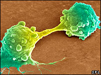 Células de câncer se dividindo