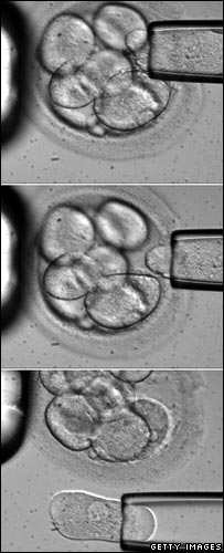 Stem Cells being extracted from an embryo