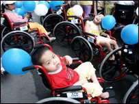 Nạn nhân chất độc da cam - ảnh Tuổi Trẻ