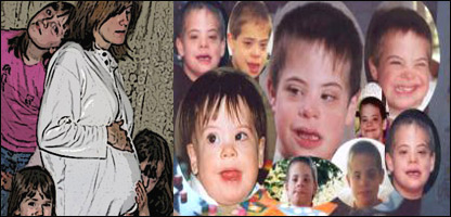 دماشومانو ذهني کمزوري