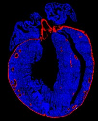 دِل کی تصویر