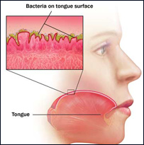 د خولې بد بوی