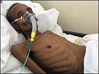 Paciente de tuberculose