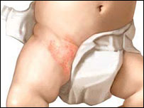 د ماشوم شړېدل