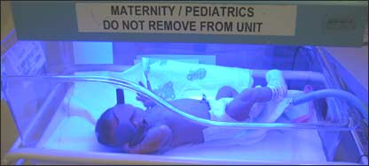 نوی زېږېدلی ماشوم چې ژېړى لري، په ماشين کې اچول شوی.