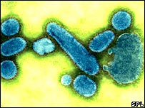 Vírus da gripe espanhola