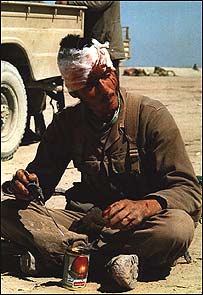 سرباز مجروح ایرانی در جنگ