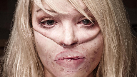 Katie in a mask she wears as part of her treatment