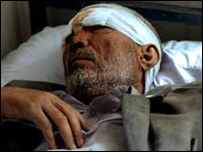 یکی از مجروحان حمله انتحاری در بیرون سفارت هند