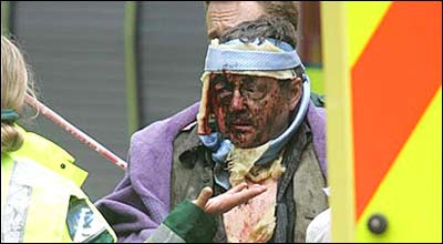 يکی از هفتصد مجروح حملات هفت ژوئيه