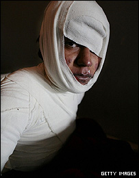 یک قربانی خودسوزی در بیمارستان هرات