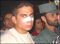 يک تن از مجروحان کنسرت